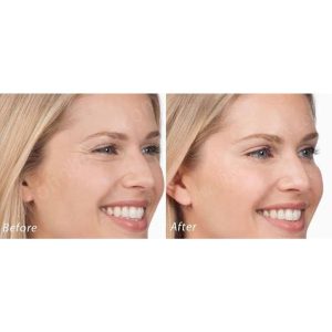 تثبیت کننده ابرو اورجینال برند Akolife مدل Kaş Kaldırma Tokası کد 359348783