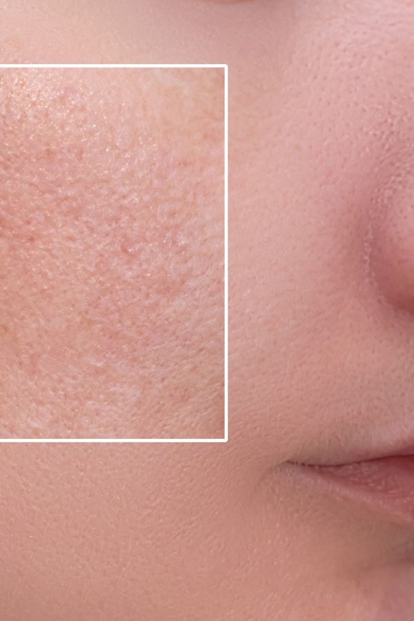 سرم پوست اورجینال برند Pro pure skin care کد 825882593 - Image 2