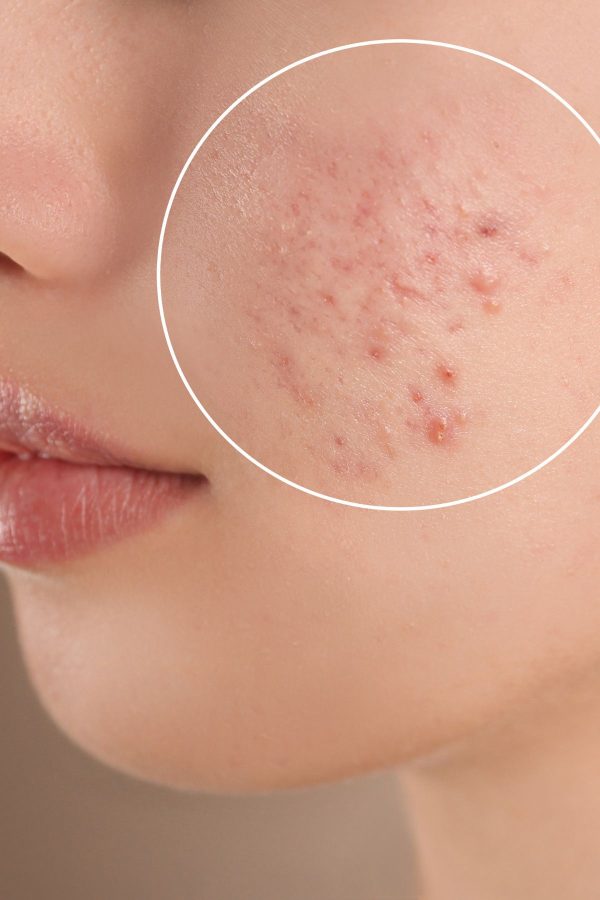 سرم پوست اورجینال برند Pro pure skin care کد 825882593 - Image 3