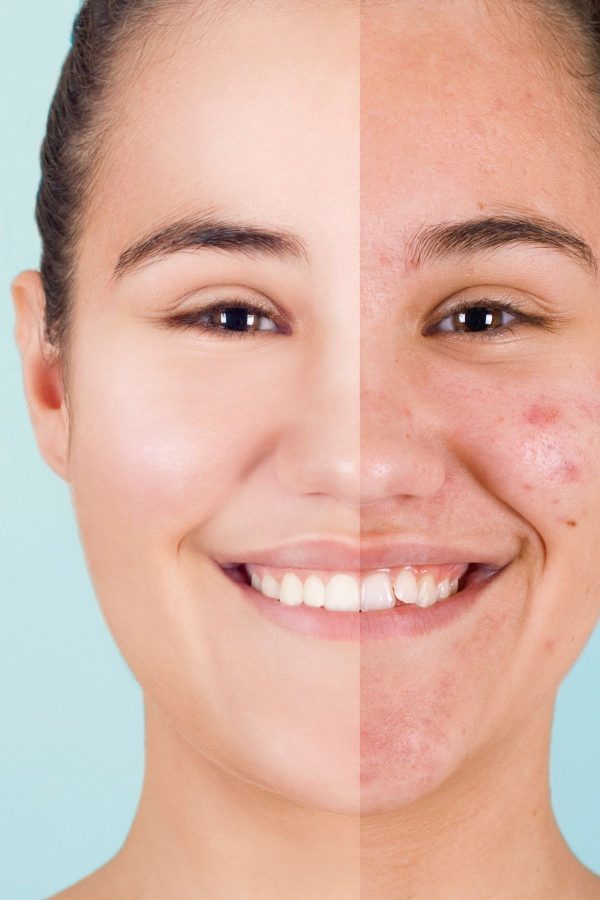 سرم پوست اورجینال برند Pro pure skin care کد 825882593 - Image 4