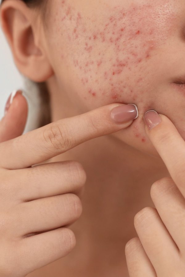 سرم پوست اورجینال برند Pro pure skin care کد 825882593 - Image 5