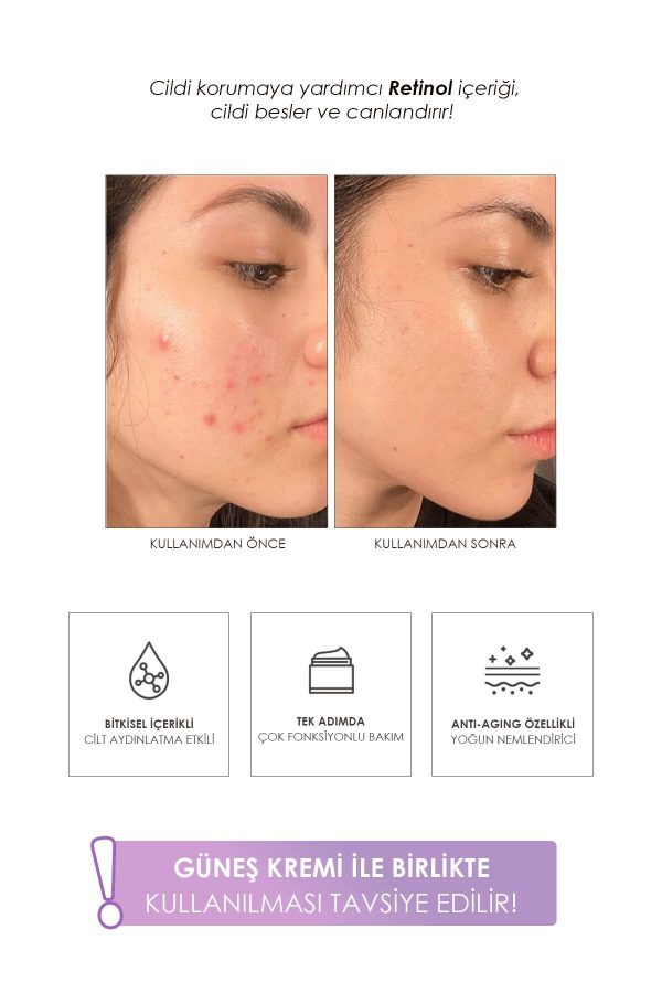 کرم صورت اورجینال برند Prettyskin کد 770308425 - Image 5