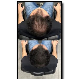 حجم دهنده مو اورجینال برند Batci کد 810757950
