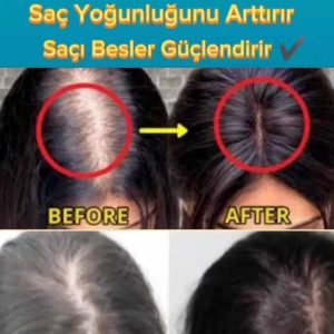ست مراقبت از مو اورجینال برند Purexpose کد 663665323