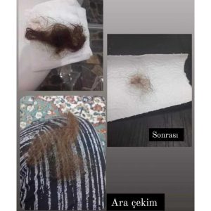 روغن و سرم مو اورجینال برند Gonul unlu کد 752975613