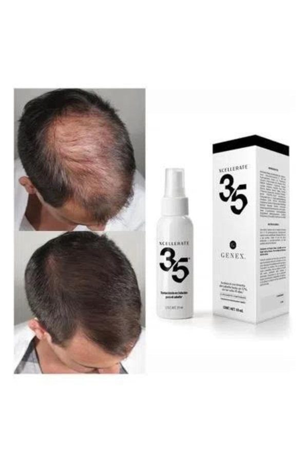 اسپری مو اورجینال برند Xcellerate 35 کد 291376076 - Image 3