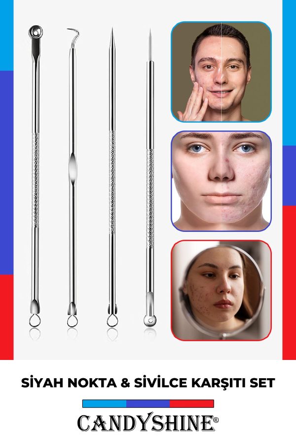 ابزار پاکسازی جوش سر سیاه اورجینال برند Candyshine کد 38153013 - Image 6