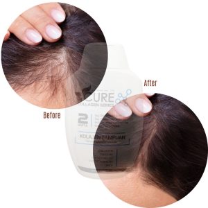 شامپو اورجینال برند Dr cure کد 830392554