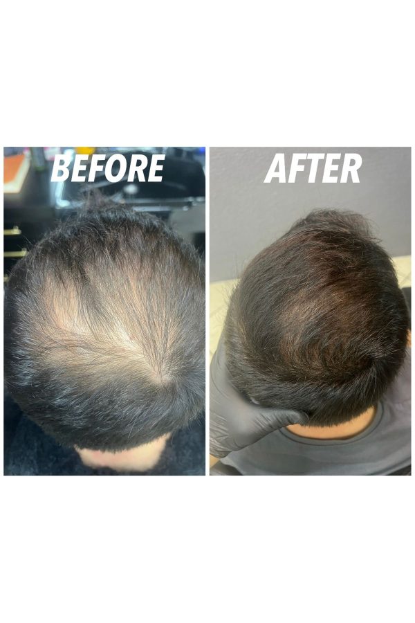 روغن و سرم مو اورجینال برند Sd hair مدل This is a hair serum کد 815092345 - Image 3