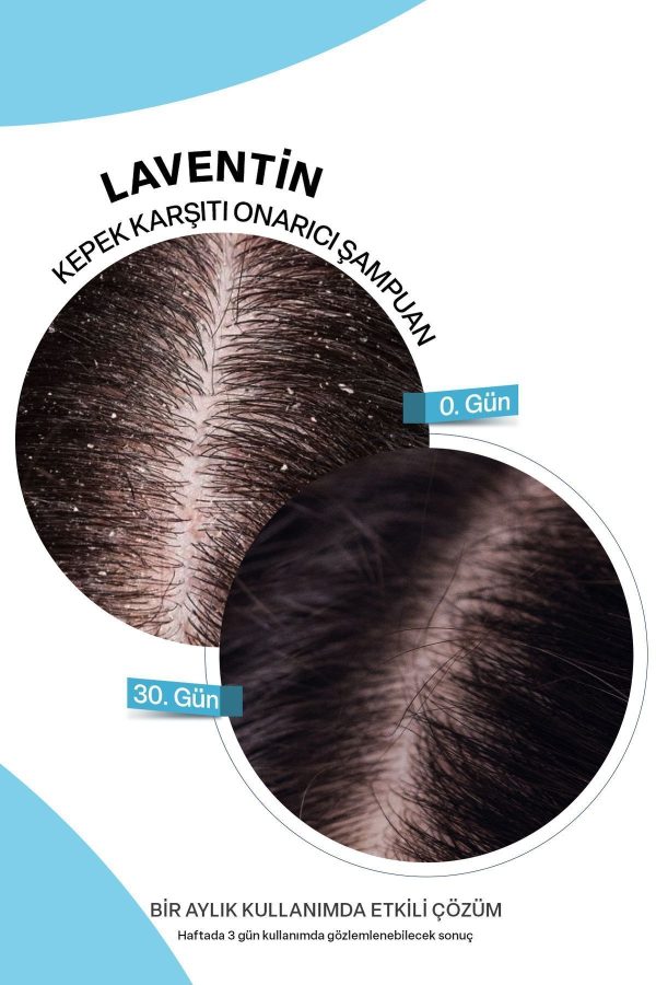 شامپو اورجینال برند Laventin مدل 11 Active Anti-Dandruff Salt-Free Shampoo کد 816974161 - Image 4
