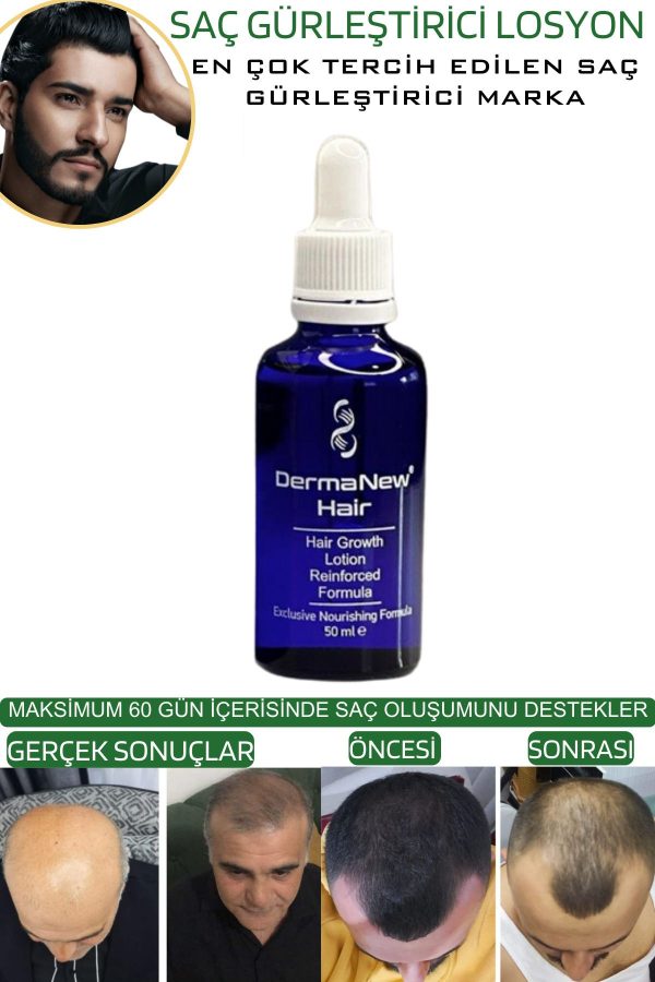 روغن و سرم مو اورجینال برند Dermanew hair کد 794809368 - Image 6