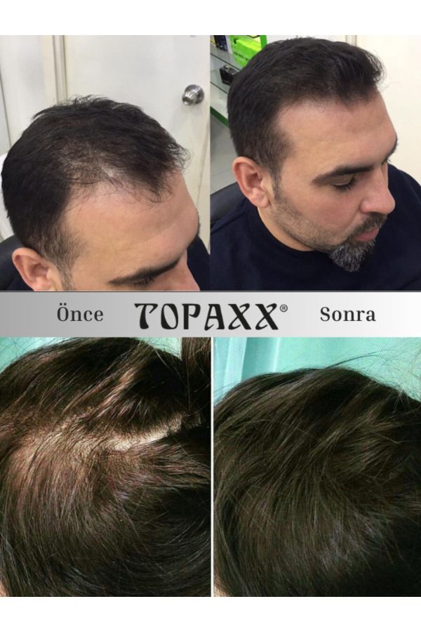 رنگ مو اورجینال برند Topaxx کد 266820174 - Image 6