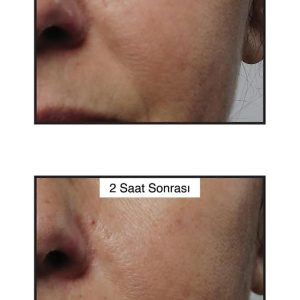 سرم پوست اورجینال برند Murad کد 34542158