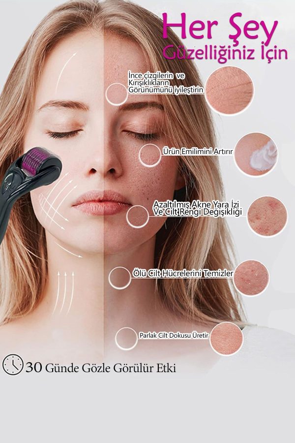 درمارولر اورجینال برند Efege مدل 540 Iğne 0,5mm Titanyum Uçlu کد 823946107 - Image 5