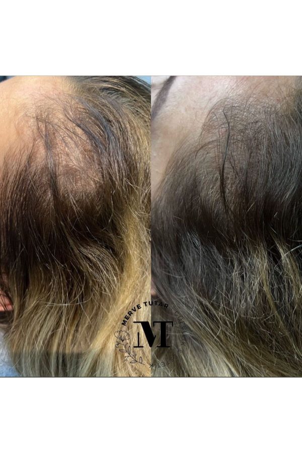 روغن و سرم مو اورجینال برند L aurore organic skin کد 807704228 - Image 8