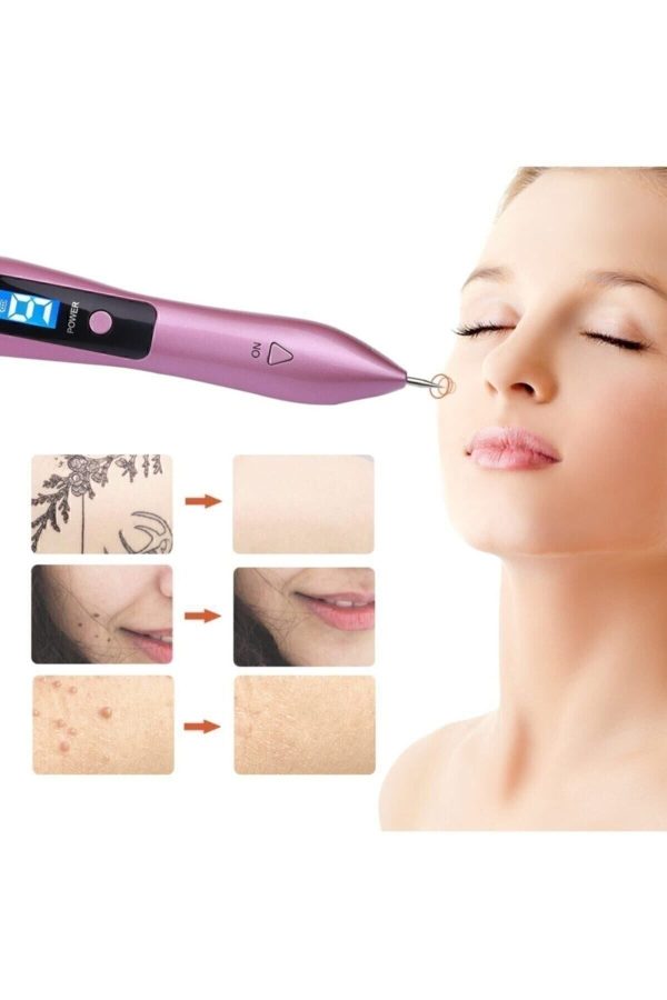 دستگاه پاکسازی صورت اورجینال برند Duende medikal kozmetik کد 65287038 - Image 3
