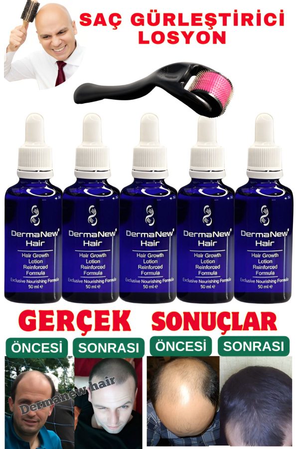 روغن و سرم مو اورجینال برند Dermanew hair مدل Hair Loss Treatment Serum کد 767155384