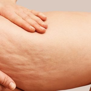 برس سلولیت اورجینال برند Efsoon organics کد 278778156