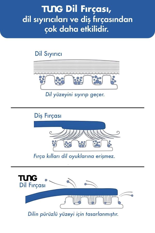 شوینده زبان اورجینال برند Tung کد 2864601 - Image 3