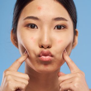 سرم پوست اورجینال برند Pro pure skin care کد 825882612