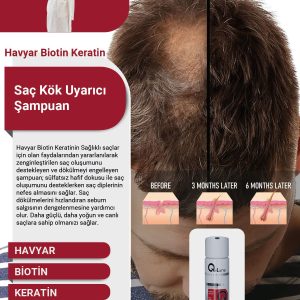شامپو اورجینال برند Q lune مدل Stimulant Clinical Shampoo کد 90162000
