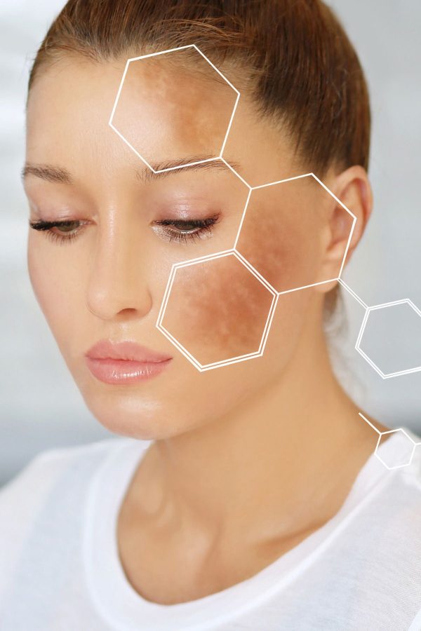 سرم پوست اورجینال برند Pro pure skin care کد 825882677 - Image 5