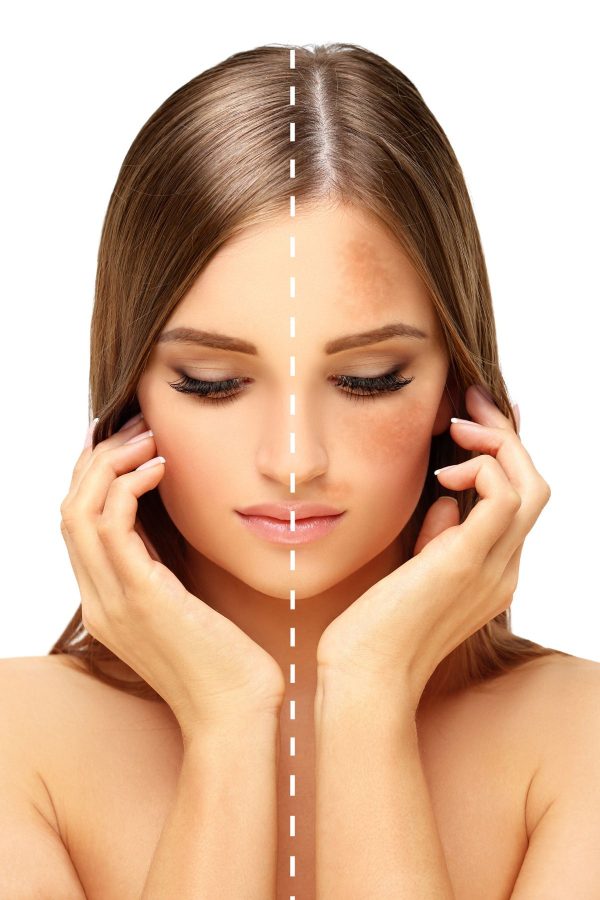 سرم پوست اورجینال برند Pro pure skin care کد 825882677 - Image 6
