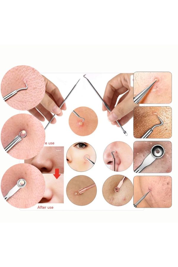 ابزار پاکسازی جوش سر سیاه اورجینال برند Lesvip s کد 741953489 - Image 2