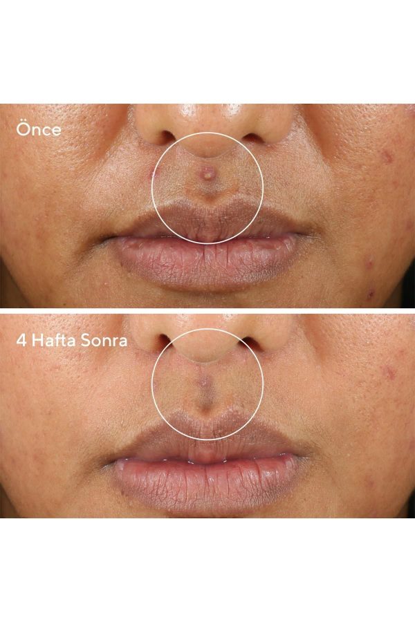 ماسک صورت اورجینال برند Murad مدل Rapid Relief Sulfur Mask کد 762926035 - Image 5