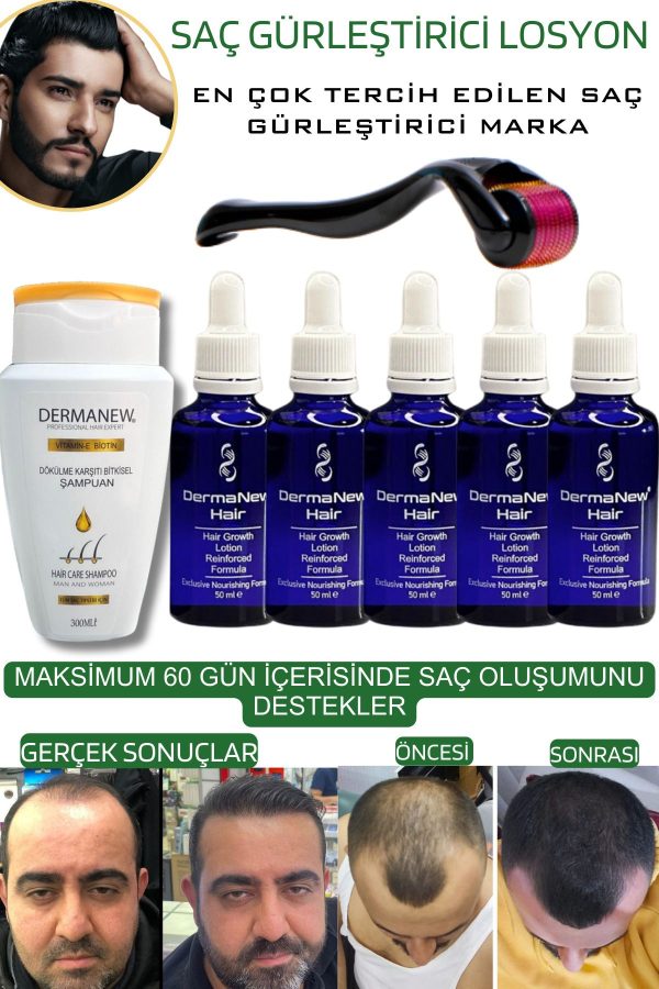 روغن و سرم مو اورجینال برند Dermanew hair کد 81304463