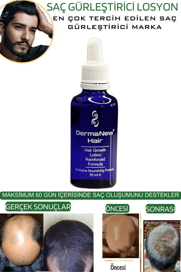 روغن و سرم مو اورجینال برند Dermanew hair کد 81304463 - Image 3