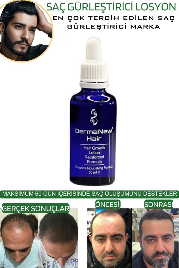 روغن و سرم مو اورجینال برند Dermanew hair کد 81304463 - Image 5