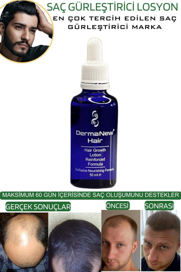روغن و سرم مو اورجینال برند Dermanew hair کد 81304463 - Image 7
