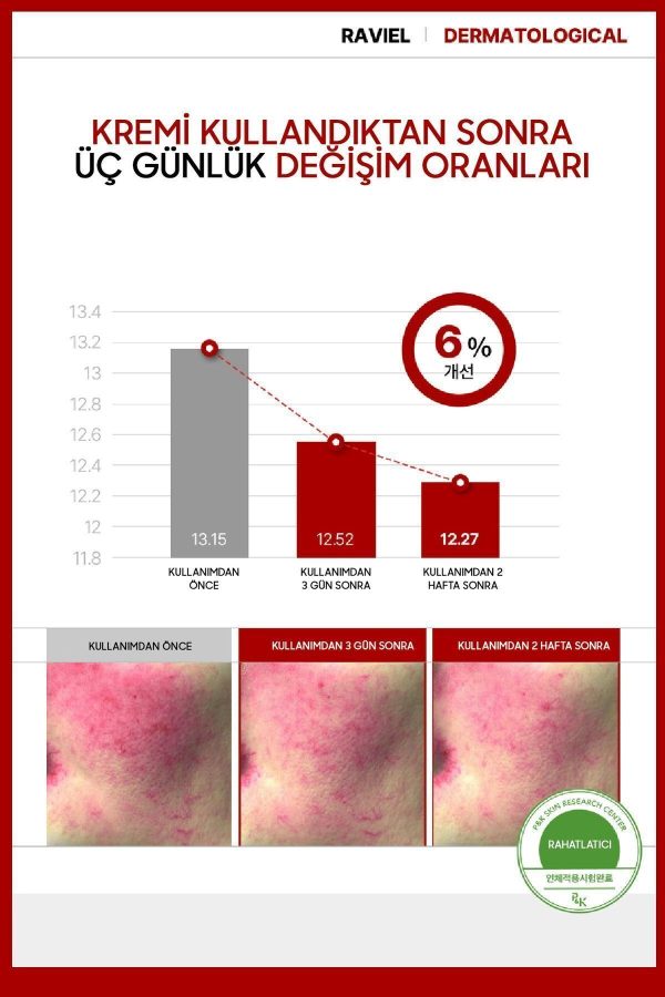 کرم صورت اورجینال برند Raviel just enough مدل Dark Spot Blemish Care Cream کد 831331549 - Image 4