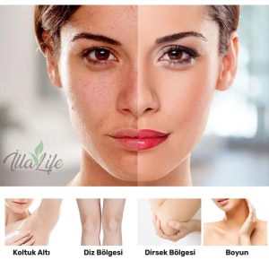 کرم صورت اورجینال برند Illa life کد 775381857