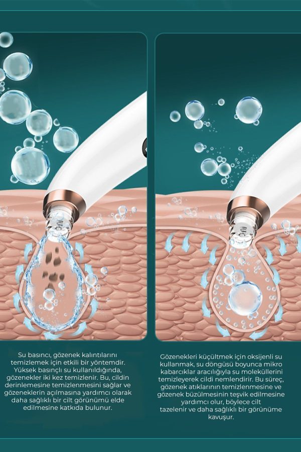 دستگاه پاکسازی صورت اورجینال برند Neutron مدل Vakumlu Ultrasonik Siyah Nokta Temizleyici کد 797674317 - Image 6