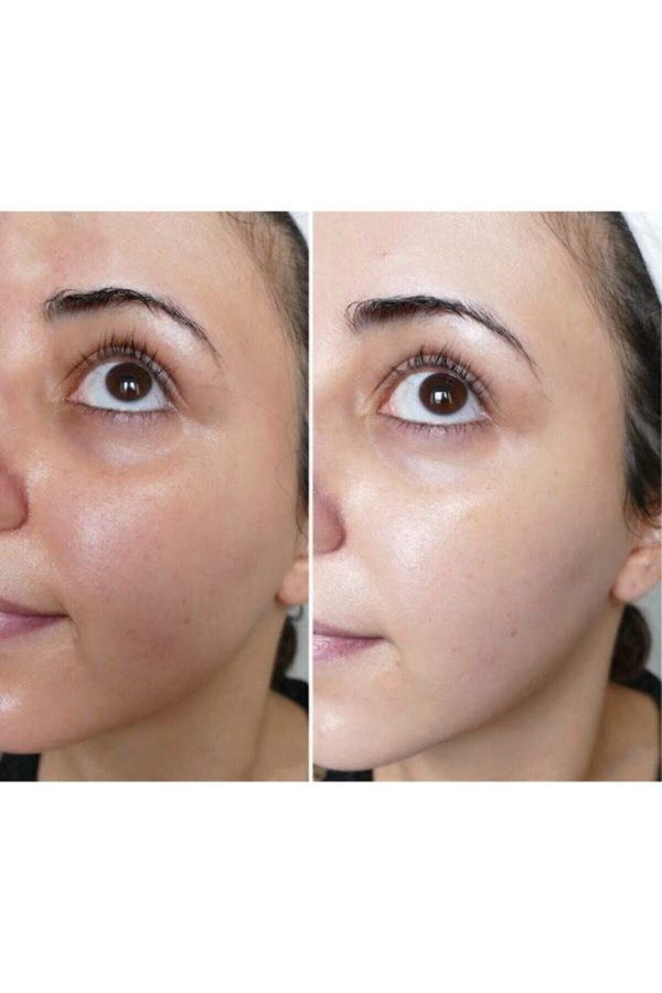 صابون جامد اورجینال برند Roesia rose cosmetics مدل Skin Whitening Soap کد 132882645 - Image 2