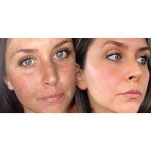 کرم صورت اورجینال برند Roesia rose cosmetics مدل Cosmetics for acne and pimples کد 106492384