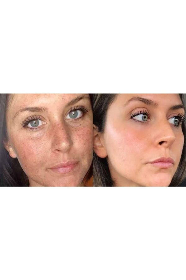 کرم صورت اورجینال برند Roesia rose cosmetics مدل Cosmetics for acne and pimples کد 106492384 - Image 2
