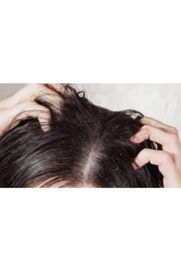 ست مراقبت از مو اورجینال برند Proxive کد 79571745 - Image 2