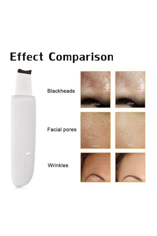 دستگاه پاکسازی صورت اورجینال برند Pazariz کد 75813067 - Image 3