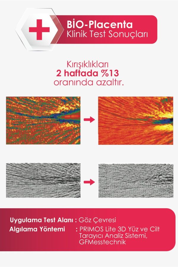 کرم صورت اورجینال برند Veela مدل Instant Ac Control Cream کد 380116710 - Image 5