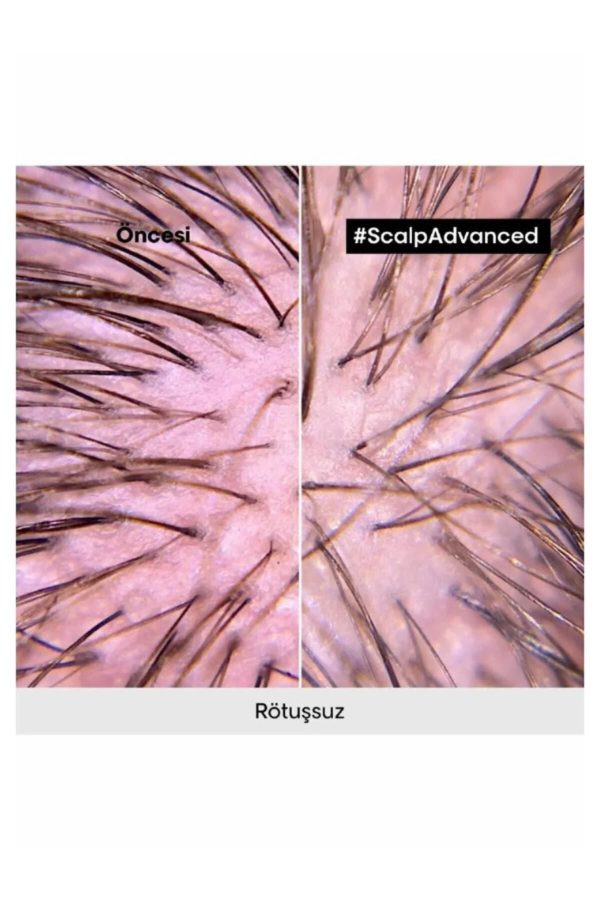 شامپو اورجینال برند L oreal professionnel کد 797973418 - Image 3