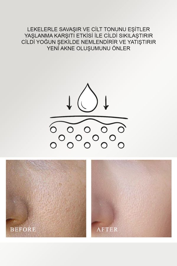 سرم پوست اورجینال برند Queen charm مدل Premium serum for acne-prone skin کد 767343429 - Image 3