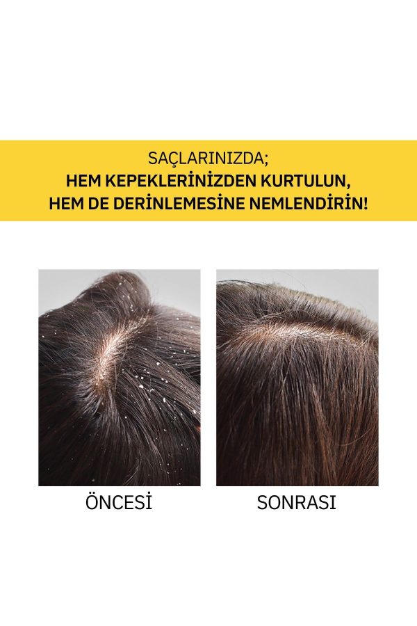 روغن و سرم مو اورجینال برند Thalia مدل Piroctone Olamine Anti-Dandruff Hair Serum کد 797337705 - Image 5