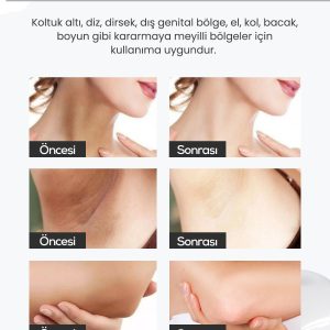 کرم بدن اورجینال برند Natural whitening skin whitening cream کد 757274798