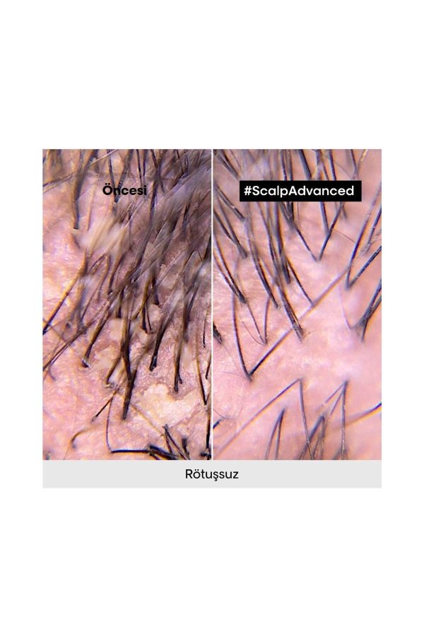 شامپو اورجینال برند L oreal professionnel کد 817579702 - Image 3