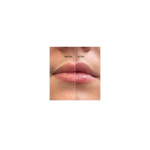 کرم لب اورجینال برند The inkey list مدل **[Product Name] Lip Balm** کد 796533908