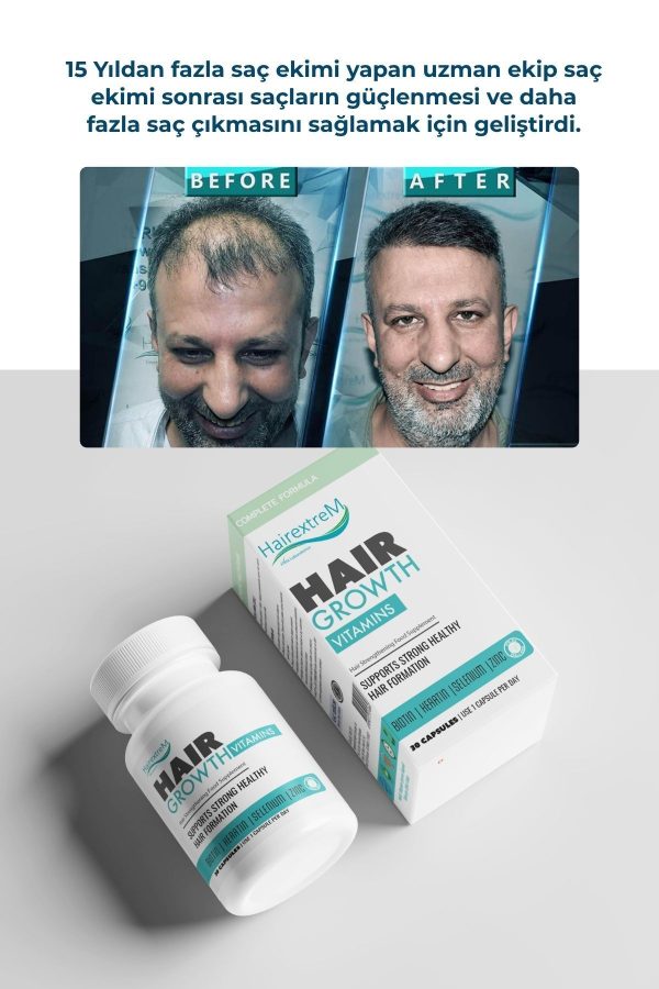 ویتامین مو اورجینال برند Hairextrem کد 311504672 - Image 2