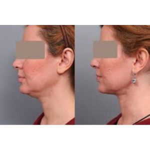 سرم پوست اورجینال برند Dr کد 797270918